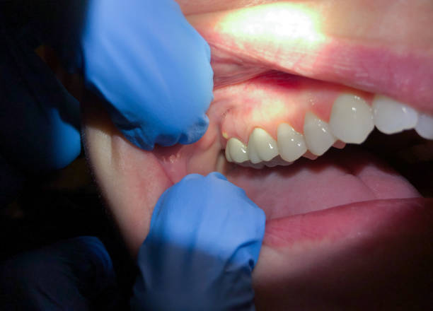  Georgetown, CT Emergency Dentist Pros